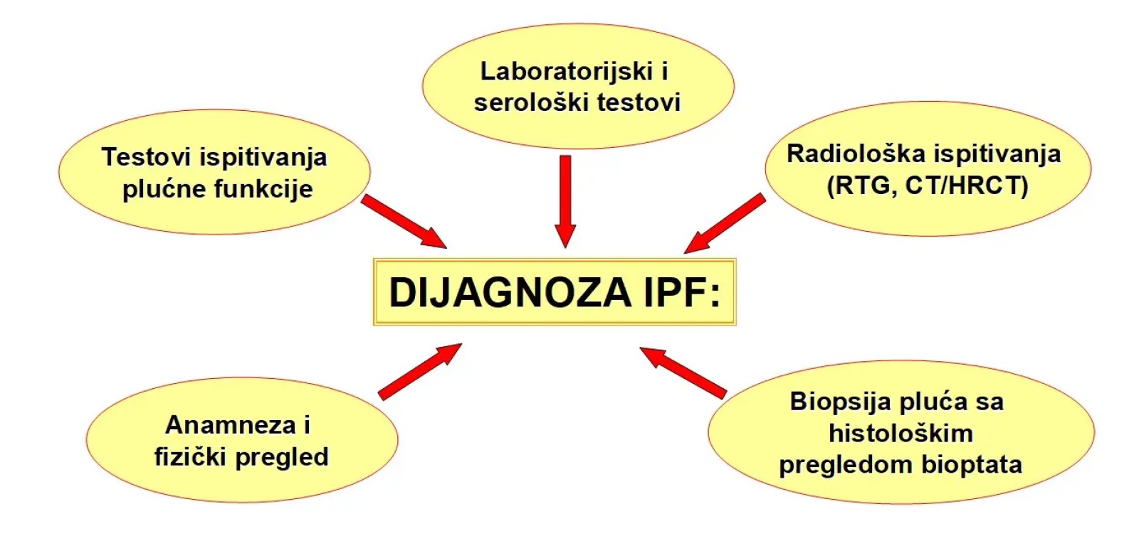 Intersticijske bolesti pluća